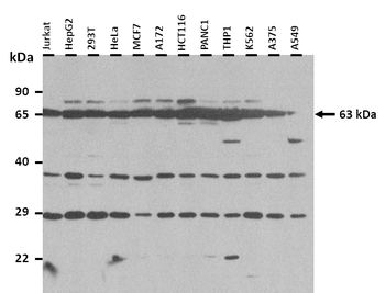 ZFP91 Rabbit Polyclonal Antibody
