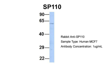 SP110 Rabbit Polyclonal Antibody