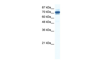 ZNF690 Rabbit Polyclonal Antibody