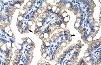 ZNF785 Rabbit Polyclonal Antibody