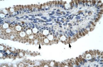 ZNF683 Rabbit Polyclonal Antibody