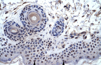 ZNF660 Rabbit Polyclonal Antibody