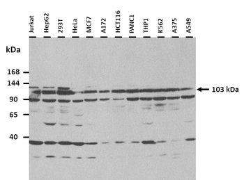 RAD54B Rabbit Polyclonal Antibody