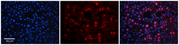 RAD54B Rabbit Polyclonal Antibody