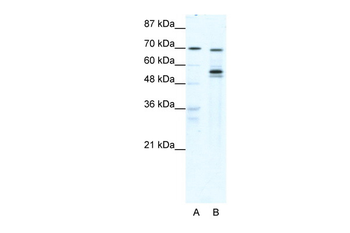 DDX55 Rabbit Polyclonal Antibody