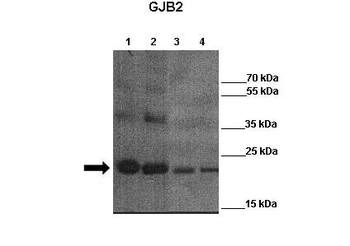 GJB2 Rabbit Polyclonal Antibody