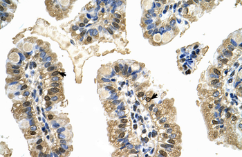 MCM8 Rabbit Polyclonal Antibody