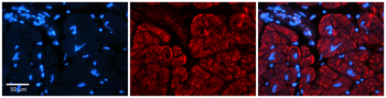 AKAP7 Rabbit Polyclonal Antibody