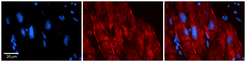AKAP7 Rabbit Polyclonal Antibody