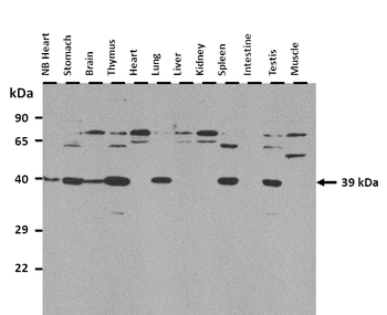 FOXH1 Rabbit Polyclonal Antibody