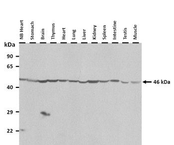 FOXD1 Rabbit Polyclonal Antibody