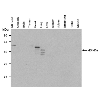 CAVIN1 Rabbit Polyclonal Antibody