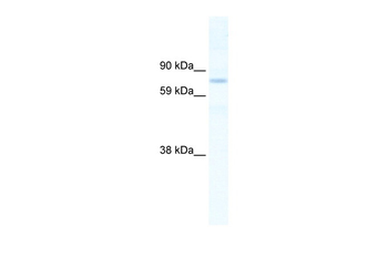 SIN3B Rabbit Polyclonal Antibody