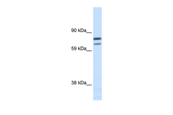 ZFPM1 Rabbit Polyclonal Antibody