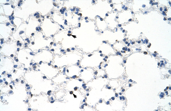 MYBBP1A Rabbit Polyclonal Antibody