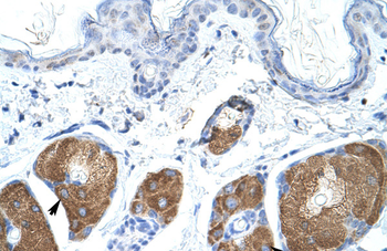 Use1 Rabbit Polyclonal Antibody