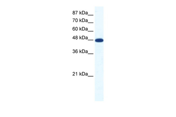 ACCN5 Rabbit Polyclonal Antibody