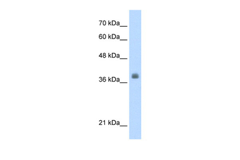 LDB1 Rabbit Polyclonal Antibody