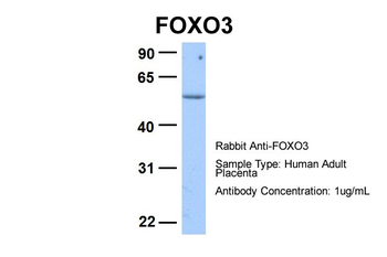 FOXO3 Rabbit Polyclonal Antibody