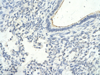 GTF2F1 Rabbit Polyclonal Antibody