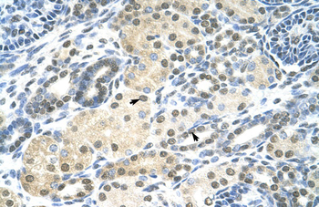 SMARCE1 Rabbit Polyclonal Antibody