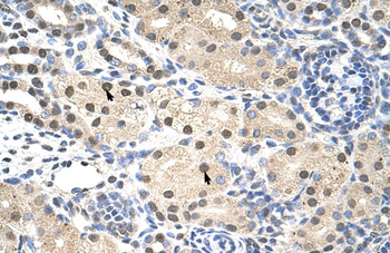 RNF14 Rabbit Polyclonal Antibody