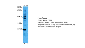 EGR3 Rabbit Polyclonal Antibody