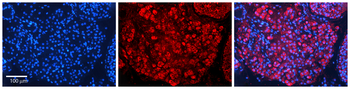 SAP18 Rabbit Polyclonal Antibody