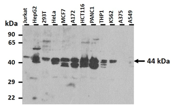 TSG101 Rabbit Polyclonal Antibody