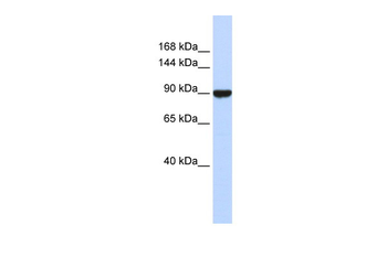 AVIL Rabbit Polyclonal Antibody