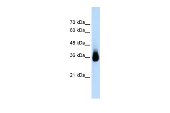 HOXC9 Rabbit Polyclonal Antibody