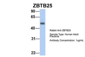 ZBTB25 Rabbit Polyclonal Antibody