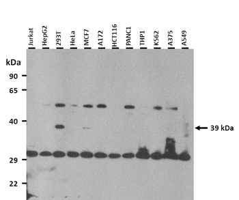 RNF113A Rabbit Polyclonal Antibody