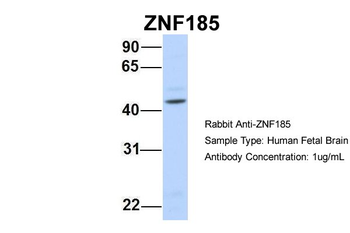 ZNF185 Rabbit Polyclonal Antibody