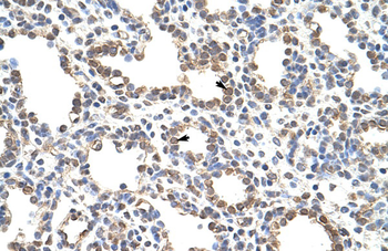 ZNF195 Rabbit Polyclonal Antibody