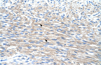 PMF1 Rabbit Polyclonal Antibody