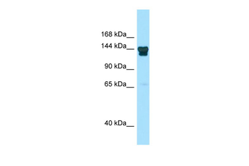 Adnp2 Rabbit Polyclonal Antibody