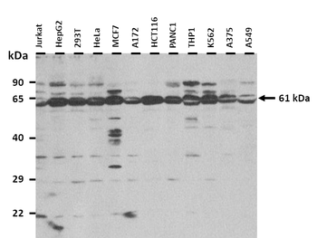 ZBTB7A Rabbit Polyclonal Antibody