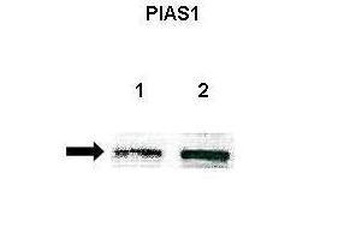 PIAS1 Rabbit Polyclonal Antibody
