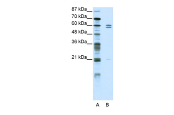 ZNF312 Rabbit Polyclonal Antibody