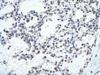 KLHL26 Rabbit Polyclonal Antibody