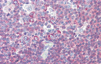BACH2 Rabbit Polyclonal Antibody