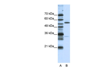 ZNF655 Rabbit Polyclonal Antibody