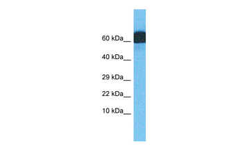 ZNF746 Rabbit Polyclonal Antibody