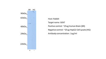 SOX7 Rabbit Polyclonal Antibody
