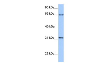 ZNF394 Rabbit Polyclonal Antibody
