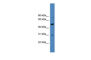 ZNF577 Rabbit Polyclonal Antibody