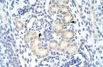 RIOX2 Rabbit Polyclonal Antibody