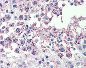 CPXCR1 Rabbit Polyclonal Antibody