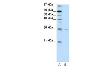 FOXQ1 Rabbit Polyclonal Antibody